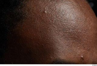 HD Face skin references Deqavious Reese forehead skin pores skin texture wrinkles 0001.jpg
